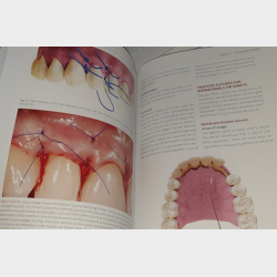 The Art of Dental Suturing - A Clinical Guide